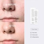 کرم ترمیم کننده دکتر التیا مدل 345 Relief Cream - تصویر 2