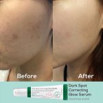 سرم ضد لک و روشن کننده اکسیس وای Axis-Y مدل Dark Spot Correcting Glow - تصویر 3