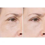 سرم رتینال آرنسیا Arencia Retinal Pore Refining مدل شات بوستر - تصویر 2