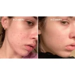 سرم صورت نیاسینامید آنوا ANUA مدل NIACINAMIDE10%+TXA4% - تصویر 3