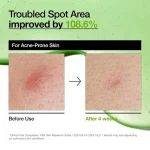 سرم صورت آزلائیک اسید آنوا ANUA مدل AZELAIC ACID +10 HYALURON - تصویر 3