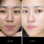 سرم آمپول ضد جوش سنتلا CENTELLA مدل RELIEF AMPOULE - تصویر 2