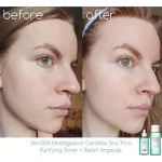سرم آمپول ضد جوش سنتلا CENTELLA مدل RELIEF AMPOULE - تصویر 3