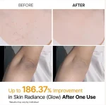 اسپری لایه‌بردار بدن و پا دکتر ملکسین مدل Peel Shot Kojic Acid & Turmeric روشن‌کننده و صاف‌کننده پوست - تصویر 3